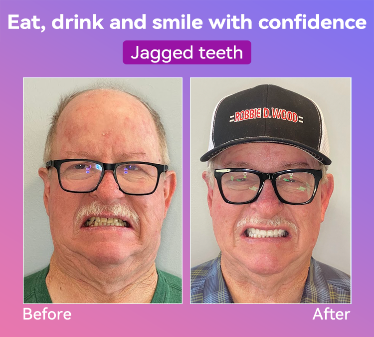 𝐉𝐚𝐬𝐬𝐞𝐞𝐦® Latest Premium Comfort Dentures👩‍⚕️🎉 (High-End Dentures, Easy to Wear - Limited Time 70% Discount)
