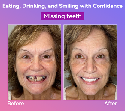 𝐉𝐚𝐬𝐬𝐞𝐞𝐦® Latest Premium Comfort Dentures👩‍⚕️🎉 (High-End Dentures, Easy to Wear - Limited Time 70% Discount)