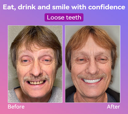 𝐉𝐚𝐬𝐬𝐞𝐞𝐦® Latest Premium Comfort Dentures🏆 (High-End Dentures, Easy to Wear - Limited Time 70% Discount)🔥