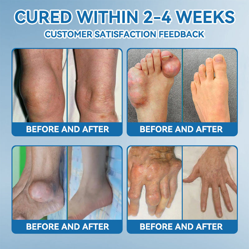 𝖯𝗂𝖼𝗱𝗼® 👍BPC-157 Joint Healing Cream🦴Treats Arthritis, Neuropathy, Rheumatism, Sports Injuries & More