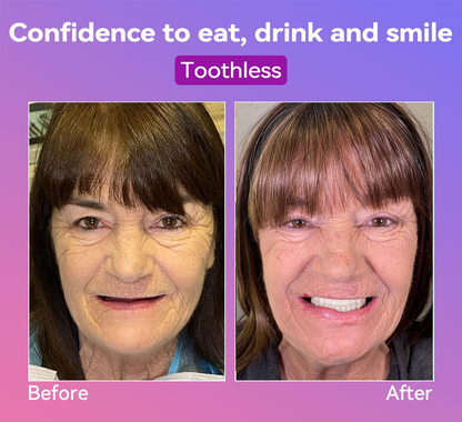 𝐉𝐚𝐬𝐬𝐞𝐞𝐦® Latest Premium Comfort Dentures👩‍⚕️🎉 (High-End Dentures, Easy to Wear - Limited Time 70% Discount)