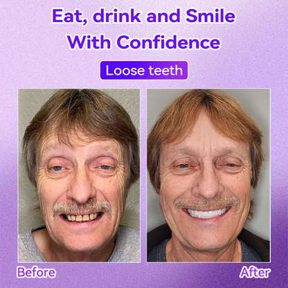 𝑂𝑓𝑓𝑖𝑐𝑖𝑎𝑙 𝑆𝑡𝑜𝑟𝑒🍀|𝐷𝑜𝑟𝑚𝑜𝑟𝑛𝑎® Teeth Restoration Mineral Powder (Recommended by the Australian Dental Association) (Flash Sale - Don’t Miss Out!)