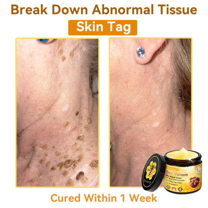 𝐃𝐨𝐫𝐦𝐨𝐫𝐧𝐚®💧Bee Venom Repair Cream (Anti-aging, deep hydration, skin repair, even skin tone, acne and dark spot treatment, removal of warts and moles, and psoriasis relief)