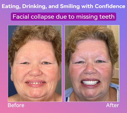 𝐉𝐚𝐬𝐬𝐞𝐞𝐦® Latest Premium Comfort Dentures👩‍⚕️🎉 (High-End Dentures, Easy to Wear - Limited Time 70% Discount)