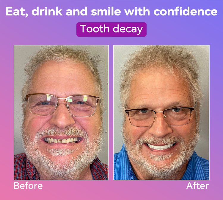 𝐉𝐚𝐬𝐬𝐞𝐞𝐦® Latest Premium Comfort Dentures👩‍⚕️🎉 (High-End Dentures, Easy to Wear - Limited Time 70% Discount)