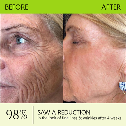 𝑂𝑓𝑓𝑖𝑐𝑖𝑎𝑙 𝑆𝑡𝑜𝑟𝑒🔥|Regain youthful skin nown 💫STDEI® BOTOX & VITA A RETINOL SHOT Wrinkle Lift Tightening Cream