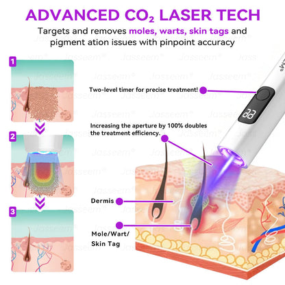 🔥 Only 10 left — 50% off today! 🎉 The 𝐉𝐚𝐬𝐬𝐞𝐞𝐦® Advanced Non-Invasive CO₂ Laser Pen is the perfect gift — whether as a backup for yourself or for family, friends, or someone special.