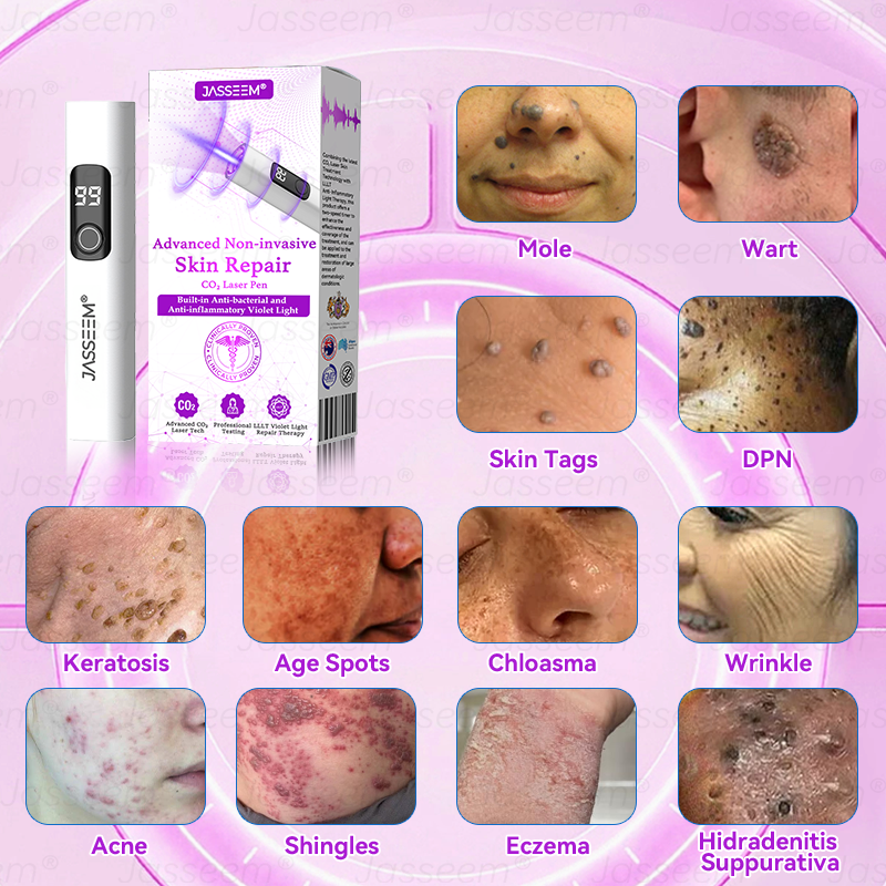 🔥 Only 10 left — 50% off today! 🎉 The 𝐉𝐚𝐬𝐬𝐞𝐞𝐦® Advanced Non-Invasive CO₂ Laser Pen is the perfect gift — whether as a backup for yourself or for family, friends, or someone special.