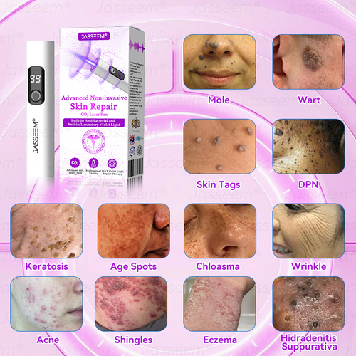 🔥 Only 10 left — 50% off today! 🎉 The 𝐉𝐚𝐬𝐬𝐞𝐞𝐦® Advanced Non-Invasive CO₂ Laser Pen is the perfect gift — whether as a backup for yourself or for family, friends, or someone special.