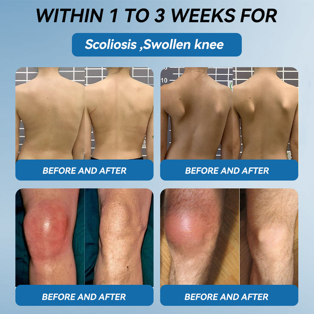 𝖯𝗂𝖼𝗱𝗼® 👍BPC-157 Joint Healing Cream🦴Treats Arthritis, Neuropathy, Rheumatism, Sports Injuries & More