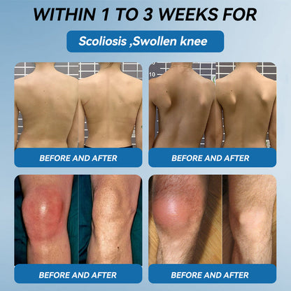 𝖯𝗂𝖼𝗱𝗼® 👍BPC-157 Joint Healing Cream🦴Treats Arthritis, Neuropathy, Rheumatism, Sports Injuries & More