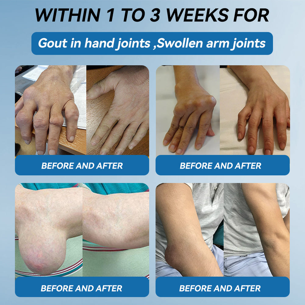 𝖯𝗂𝖼𝗱𝗼® 👍BPC-157 Joint Healing Cream🦴Treats Arthritis, Neuropathy, Rheumatism, Sports Injuries & More