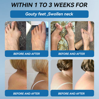 𝖯𝗂𝖼𝗱𝗼® 👍BPC-157 Joint Healing Cream🦴Treats Arthritis, Neuropathy, Rheumatism, Sports Injuries & More