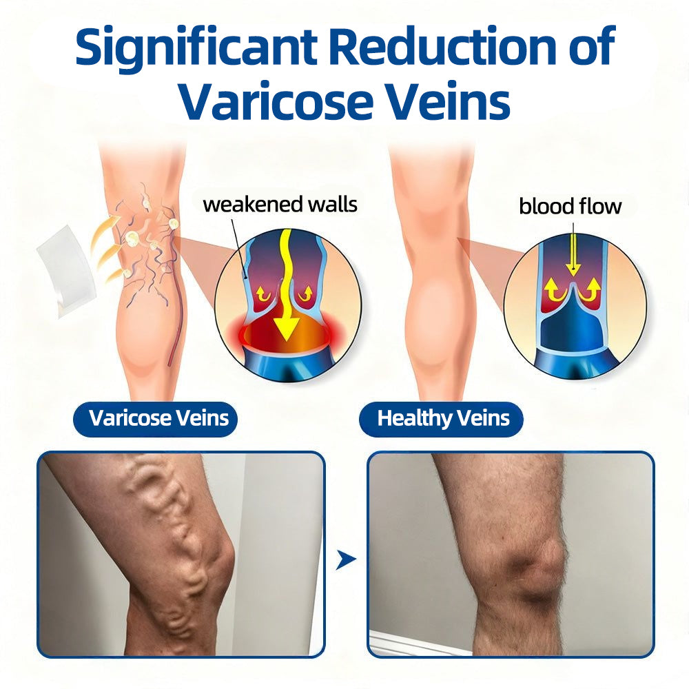 🛡️ 𝐅𝐥𝐨𝐫𝐢𝐬𝐦𝐚® 🎉 Diosmin & Hesperidin Clinical‑Grade Microneedle Patch — an advanced herbal formula designed to help reduce the appearance of spider veins and varicose veins, while easing the feeling of heavy, tired legs. 👩‍⚕️