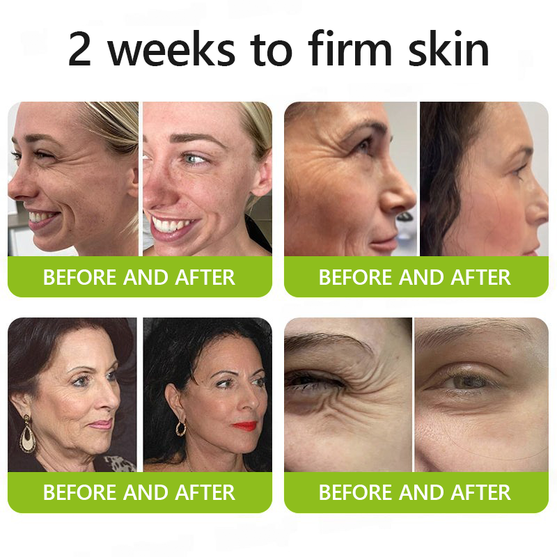 𝑂𝑓𝑓𝑖𝑐𝑖𝑎𝑙 𝑆𝑡𝑜𝑟𝑒🔥|Regain youthful skin nown 💫STDEI® BOTOX & VITA A RETINOL SHOT Wrinkle Lift Tightening Cream