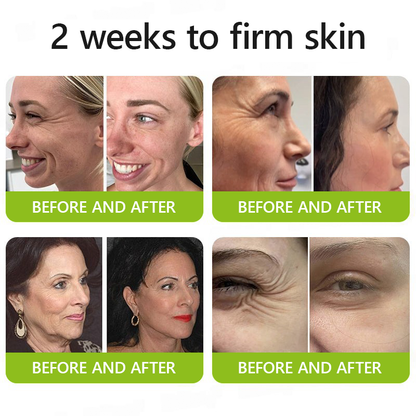 𝑂𝑓𝑓𝑖𝑐𝑖𝑎𝑙 𝑆𝑡𝑜𝑟𝑒🔥|Regain youthful skin nown 💫STDEI® BOTOX & VITA A RETINOL SHOT Wrinkle Lift Tightening Cream