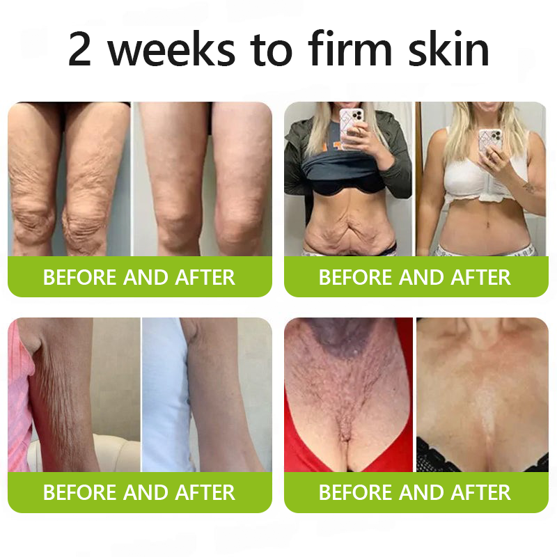 𝑂𝑓𝑓𝑖𝑐𝑖𝑎𝑙 𝑆𝑡𝑜𝑟𝑒🔥|Regain youthful skin nown 💫STDEI® BOTOX & VITA A RETINOL SHOT Wrinkle Lift Tightening Cream