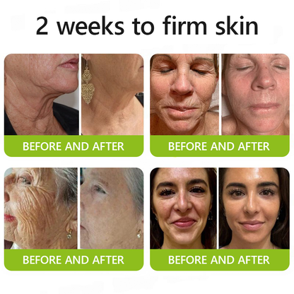 𝑂𝑓𝑓𝑖𝑐𝑖𝑎𝑙 𝑆𝑡𝑜𝑟𝑒🔥|Regain youthful skin nown 💫STDEI® BOTOX & VITA A RETINOL SHOT Wrinkle Lift Tightening Cream