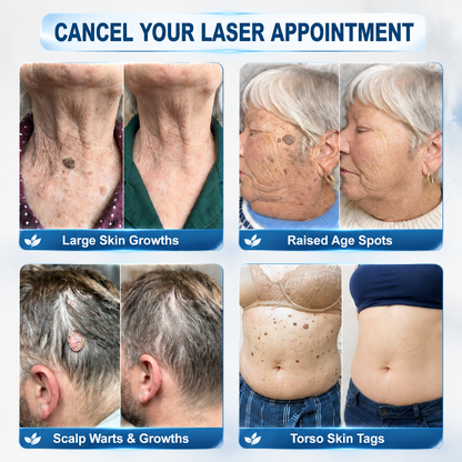 👩‍⚕️🎁 𝐎𝐟𝐟𝐢𝐜𝐢𝐚𝐥 𝐒𝐭𝐨𝐫𝐞 | 𝑵𝐞𝒌𝐢𝐬𝐬® 🌿 𝐁𝐨𝐭𝐚𝐧𝐢𝐜𝐚𝐥 𝐌𝐢𝐜𝐫𝐨𝐧𝐞𝐞𝐝𝐥𝐞 𝐇𝐲𝐝𝐫𝐨𝐜𝐨𝐥𝐥𝐨𝐢𝐝 𝐏𝐚𝐭𝐜𝐡 (𝐅𝐨𝐫 𝐒𝐤𝐢𝐧 𝐓𝐚𝐠𝐬, 𝐒𝐦𝐚𝐥𝐥 𝐒𝐤𝐢𝐧 𝐆𝐫𝐨𝐰𝐭𝐡𝐬, 𝐖𝐚𝐫𝐭𝐬, 𝐌𝐨𝐥𝐞𝐬, 𝐀𝐠𝐞 𝐒𝐩𝐨𝐭𝐬 & 𝐏𝐢𝐠𝐦𝐞𝐧𝐭𝐚𝐭𝐢𝐨𝐧 𝐂𝐨𝐧𝐜𝐞𝐫𝐧𝐬)