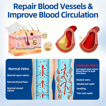 🛡️ 𝐅𝐥𝐨𝐫𝐢𝐬𝐦𝐚® 🎉 Diosmin & Hesperidin Clinical‑Grade Microneedle Patch — an advanced herbal formula designed to help reduce the appearance of spider veins and varicose veins, while easing the feeling of heavy, tired legs. 👩‍⚕️